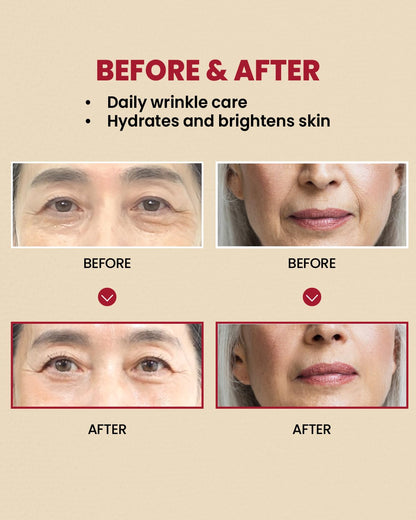Retinal Liposome 1% + Fermented Rice